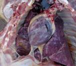 Glassers pleurisy kr 2