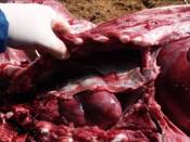 Glassers chronic1 pleurisy