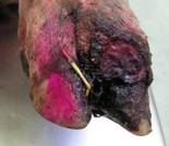 Lame Bush foot infected gross