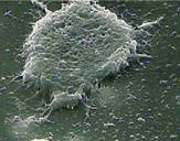 PRRS Macrophage dead