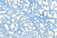 0128 21 a 4  lung neg