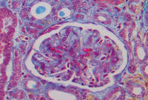 DIC kidney detail x 200