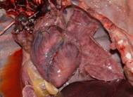 Clostridial with Pulmonary oedema