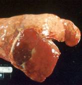 Bordetella bronochopneumonia