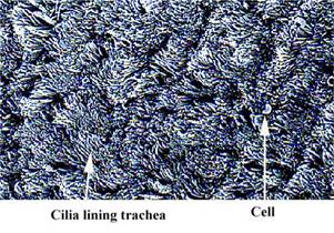 Anat Resp cilia normal label.JPG