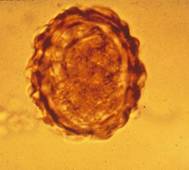 Ascaris suum egg B