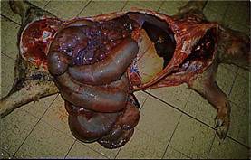 Rectal stricture