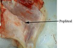 Anat lymph pop 1 labled