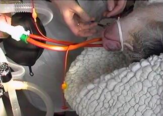 Surgery op anaethesia