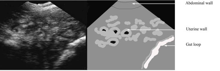 repro drawing 17 days gestation label.jpg