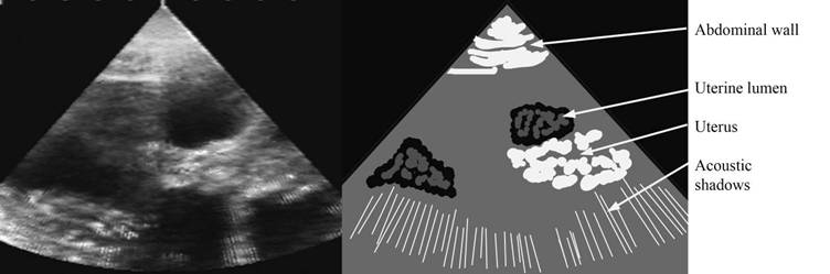 repro draw pseudopreg label.jpg