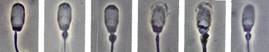 AI sperm head deformities copy