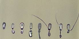 AI sperm tail abnormalities