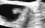 24 days gestation