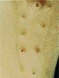 Mammary teat necrosis
