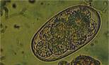Worms strongyle eggs