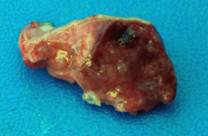 PM sample normal ab