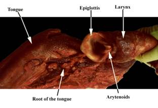 Anat larynx black label