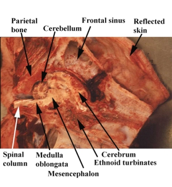 anatomy brain label