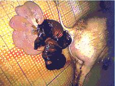 Prolapse uterus