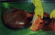 Prolapsed bladder