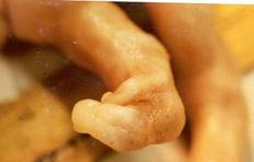 Cong Fused digit